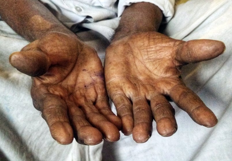 An old man's hands