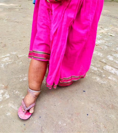 Sukhiya (who suffers from filariasis) waits for Kusum and her grandchild, who have been taken inside the vaccination room