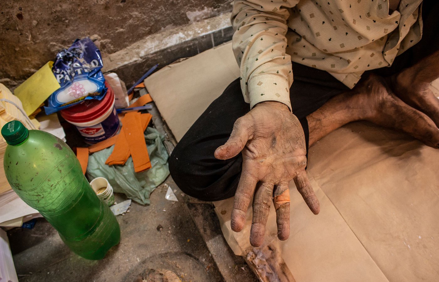 When the lai (handmade glue) touches the injured fingers they burn and pain. Kaleem Shaikh of Dhruv Envelopes shows his recent injuries