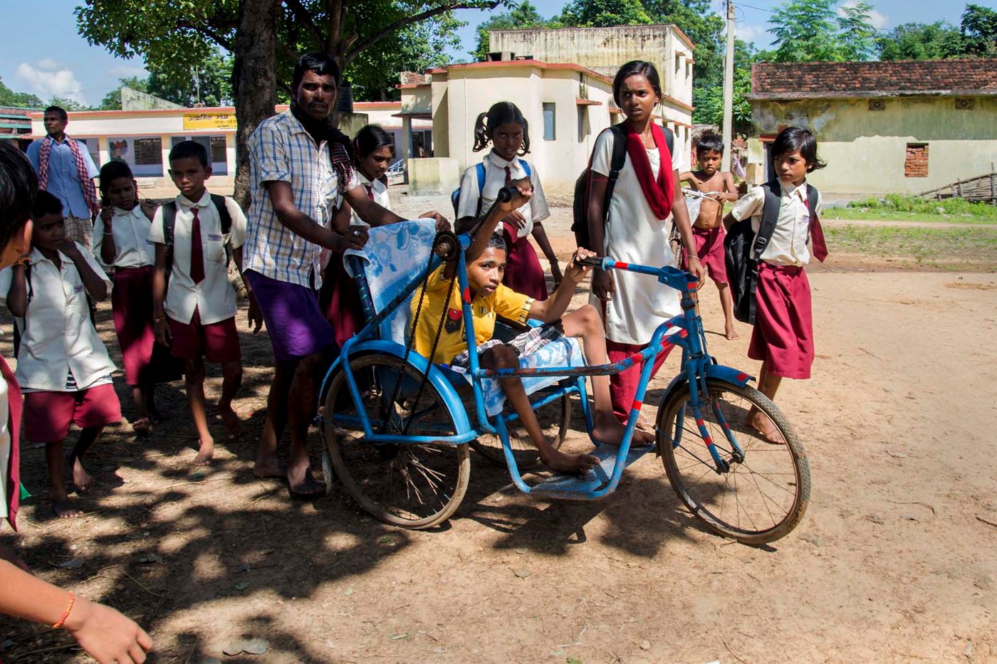 A child on wheelchair suffering cerebral palsy